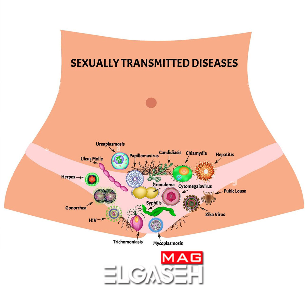 بیماری های مقاربتی نام عوامل ایجاد بیماری مقاربتی